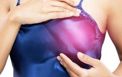 Phát hiện 72 biến thể gene khiến phụ nữ tăng nguy cơ mắc ung thư vú