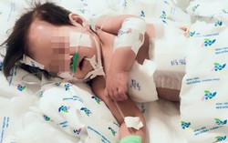 Cứu sống bé gái 10 tháng tuổi bị thủng thực quản cực kỳ nguy kịch