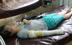 Vợ đi làm đẹp bị chồng đổ nước sôi lên đầu