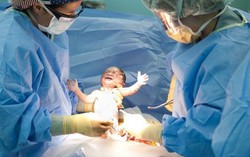 Bác sĩ 'cạn lời' thuyết phục mới được sản phụ mang thai đôi bị suy thai 'cho' mổ 