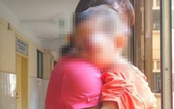 Bị mù sau 5 ngày điều trị viêm giác mạc