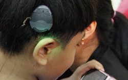 Cơ hội trẻ nghe kém được cấy ốc tai điện tử miễn phí