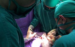 Vừa chào đời, bé đã bị phình đại tràng