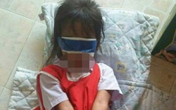 2 bé gái 5 tuổi bị trói tay, bịt mắt vì nghịch trong giờ học