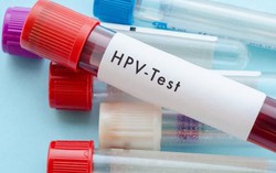 Nhiễm virus HPV dai dẳng là nguy cơ chính gây ung thư cổ tử cung