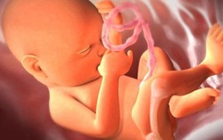 Bệnh viện đầu tiên trong nước xử lý tổn thương từ giai đoạn bào thai