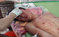 Khởi tố, bắt côn đồ đánh thầy trò trường THPT Lê Lợi
