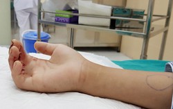 Xô nhau vào vào thang máy, bé 9 tuổi suýt mất ngón tay