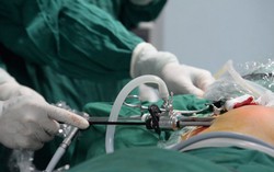 Lần đầu tiên mổ nội soi u xơ tuyến vú cả hai bên không để lại sẹo