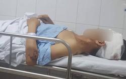 Hôn mê, vỡ gan sau khi quá chén với bạn cũ