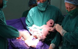 Gây mê mổ lấy thai bằng phương pháp nào tốt nhất cho sản phụ?