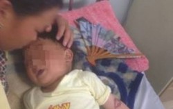 Bé trai 3 tuổi bỏng thực quản, dạ dày vì ăn nhầm hóa chất
