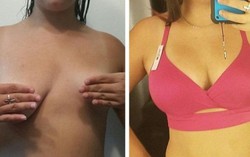 Cha bán nhà lấy tiền cho con gái nâng ngực