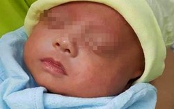 Nuôi sống trẻ sơ sinh to chỉ bằng… bàn tay