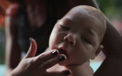 Cả hai trường hợp nhiễm zika tại VN đều là nữ