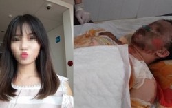 Cô gái trẻ bị bỏng nặng toàn thân