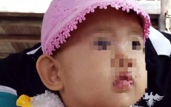 Cần làm rõ nguyên nhân bé 29 tháng tuổi bị sốt, tiêu chảy tử vong tại bệnh viện