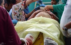 2 trong số 3 phụ nữ sống sót trong tai nạn máy bay ở Cuba đã tỉnh