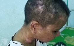 Khởi tố, bắt tạm giam kẻ tra tấn dã man người giúp việc ở Gia Lai