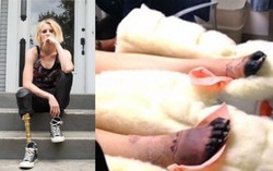 Người mẫu phải cắt chân vì băng vệ sinh 