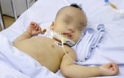 Cứu sống bệnh nhi bị sốc nhiễm trùng cận kề cái chết