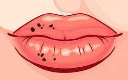 8 dấu hiệu ở môi tiết lộ tình trạng sức khỏe của bạn