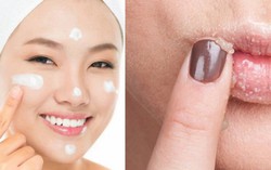 3 bước đơn giản dưỡng nhan sắc mùa hanh khô
