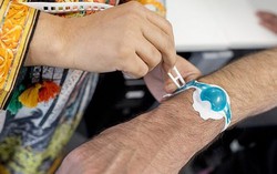Tiêm, truyền dễ dàng hơn nhờ công nghệ lấy cảm hứng từ vết cắn yêu