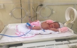 Sau cú ngã đập mông xuống đất, bà bầu phải mổ cấp cứu lấy thai