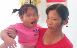 Vụ cháu bé méo miệng nghi bị cô giáo đánh: Công an vào cuộc xác minh