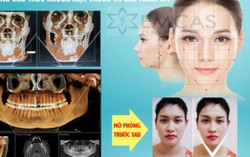 Thiếu phụ hôn mê sau phẫu thuật gọt hàm tại Bệnh viện Thẩm mỹ EMCA