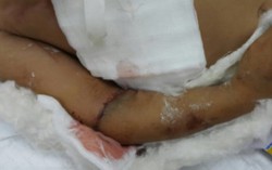 Theo mẹ đến công xưởng, bé trai phải cắt tay vì băng chuyền sản xuất