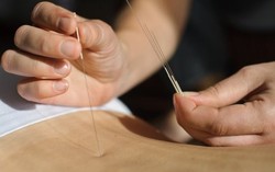 Châm cứu, xăm mình cũng có thể mắc viêm gan siêu vi C