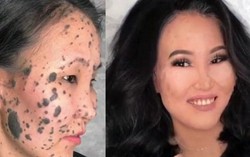 Xem phù thủy trang điểm biến hóa cô nàng 'da báo' trở nên mịn màng