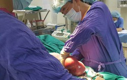 Tưởng béo bụng, hóa ra đang mang 20 u mỡ