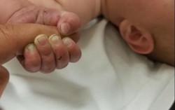 Bé trai 5 tháng tuổi sống sót sau 9 giờ bị chôn sống dưới 7 độ C