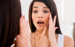Mụn "tấn công" nàng U50