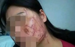 Chồng tiếp tay cho bồ đánh ghen vợ dã man
