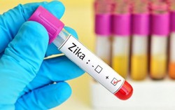 Người dân không nên tự xét nghiệm virus Zika