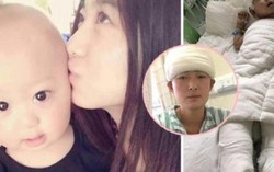Mẹ nghèo hiến da đầu cứu con trai bị bỏng