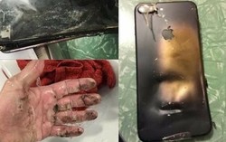 5 cách phòng tránh smartphone phát nổ