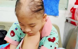 Xót xa hoàn cảnh nữ sinh lớp 8 bị ung thư xương đứng trước nguy cơ phải cắt chân