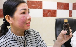 Rước họa vì dùng mỹ phẩm làm trắng da cấp tốc đón tết