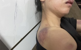 Công an truy tìm người chồng tra tấn vợ "thừa sống thiếu chết" ở Yên Bái