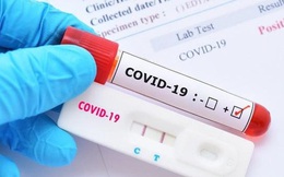 Bộ Y tế nói gì trước thông tin về test kit xét nghiệm Covid-19 ở Việt Nam cao hơn thế giới?