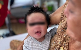 Cứu sống bé 16 ngày tuổi sốt cao, rốn lồi lên do mẹ không tiêm ngừa trong thai kỳ