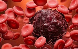 Nhiễm trùng máu có phải là ung thư máu không?