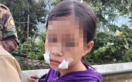 Bán hoa quả bên lề đường, bé gái 9 tuổi bị thanh niên bịt miệng cướp tài sản