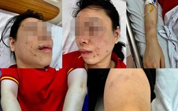 Người phụ nữ tố bị chồng cũ "bắt cóc" tra tấn dã man: Nhốt trong ô tô, đánh từ Hà Nội lên Hòa Bình