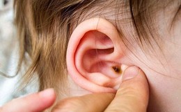 Biến chứng đáng sợ của viêm tai giữa và cách phòng tránh từ chuyên gia